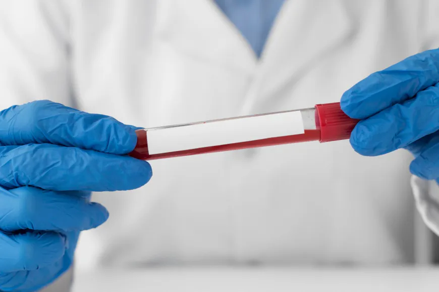 What is Ferritin Serum Plasma?